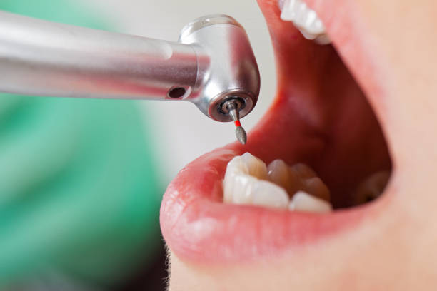 Best Broken Tooth Emergency  in Mooreland, OK